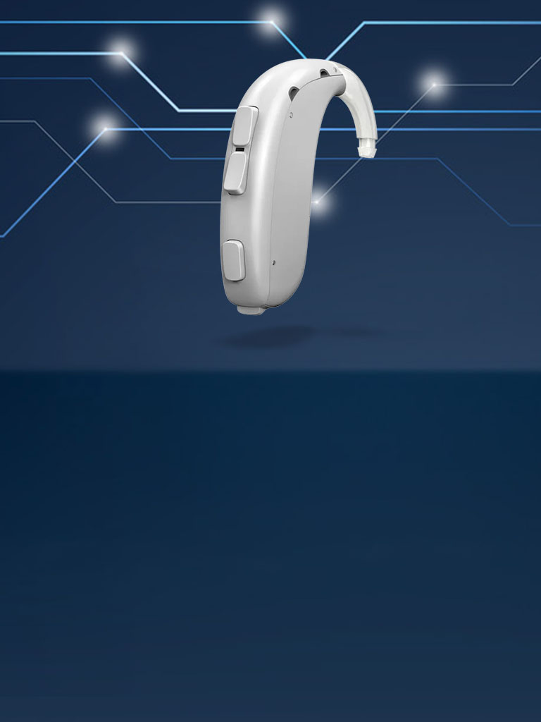 Xceed 1